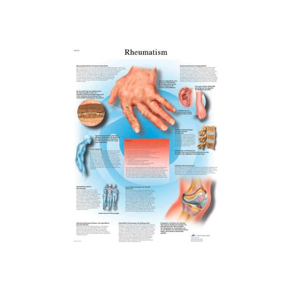 3B Anatomical Chart - Rheumatic Diseases, Paper